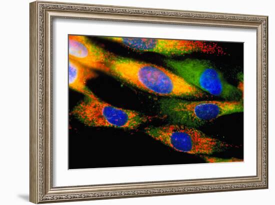 Cytomegalovirus Infection-Nancy Kedersha-Framed Photographic Print