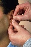 Acupuncturist's Hands Insert Needle Into Man's Ear-Damien Lovegrove-Framed Photographic Print