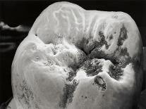 Decay on Molar Tooth, SEM-David McCarthy-Photographic Print