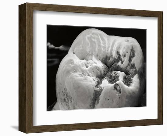 Decay on Molar Tooth, SEM-David McCarthy-Framed Photographic Print