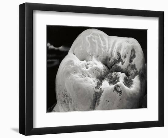 Decay on Molar Tooth, SEM-David McCarthy-Framed Photographic Print