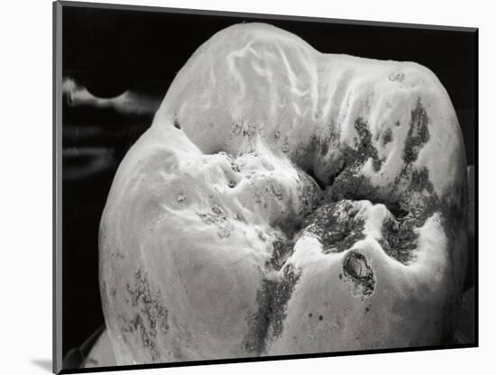 Decay on Molar Tooth, SEM-David McCarthy-Mounted Photographic Print