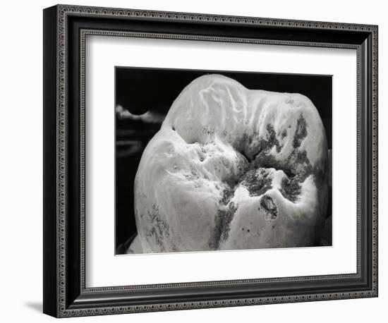 Decay on Molar Tooth, SEM-David McCarthy-Framed Photographic Print