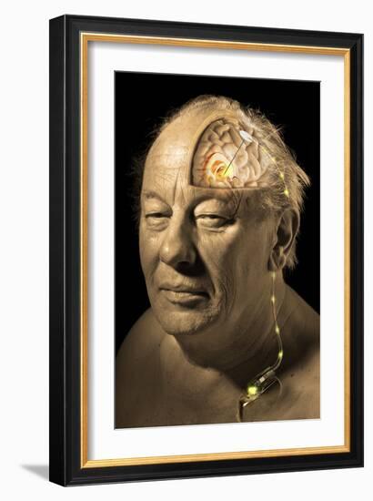 Deep Brain Stimulation, Artwork-Tim Vernon-Framed Photographic Print