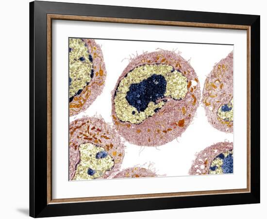 Dendritic Cell, TEM-Biomedical Imaging-Framed Photographic Print