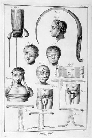 Breast Surgery, 1751-1777 by Print Collector