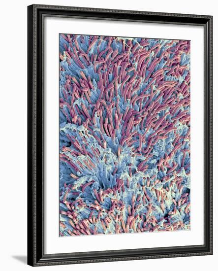 Dental Plaque, SEM-Steve Gschmeissner-Framed Photographic Print