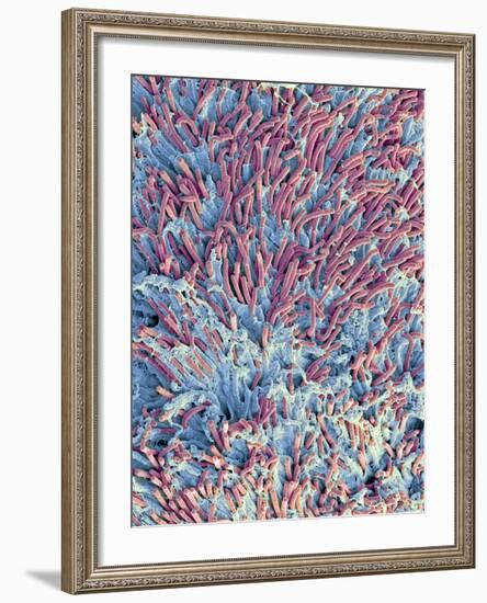 Dental Plaque, SEM-Steve Gschmeissner-Framed Photographic Print