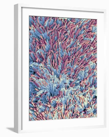 Dental Plaque, SEM-Steve Gschmeissner-Framed Photographic Print