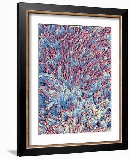 Dental Plaque, SEM-Steve Gschmeissner-Framed Photographic Print