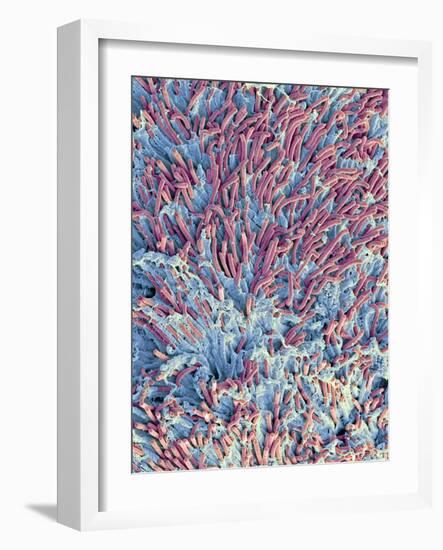 Dental Plaque, SEM-Steve Gschmeissner-Framed Photographic Print