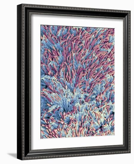 Dental Plaque, SEM-Steve Gschmeissner-Framed Photographic Print