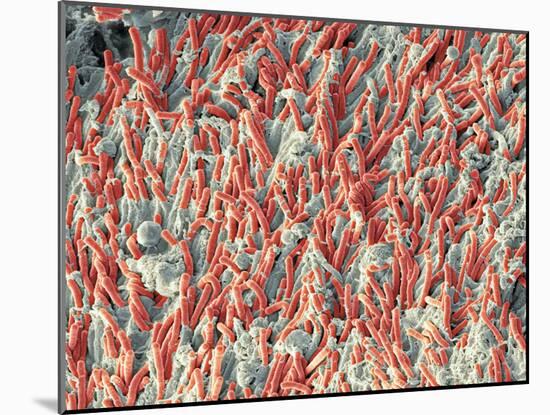 Dental Plaque, SEM-Steve Gschmeissner-Mounted Photographic Print