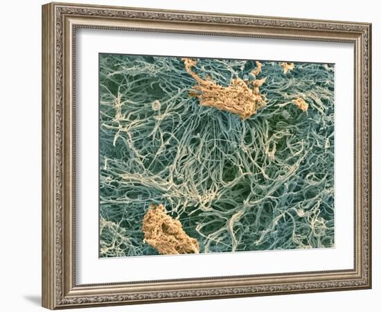 Dental Plaque, SEM-Steve Gschmeissner-Framed Photographic Print