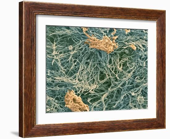 Dental Plaque, SEM-Steve Gschmeissner-Framed Photographic Print