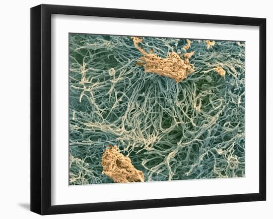 Dental Plaque, SEM-Steve Gschmeissner-Framed Photographic Print