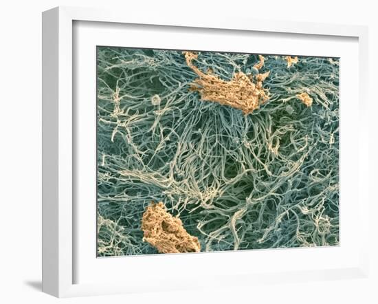 Dental Plaque, SEM-Steve Gschmeissner-Framed Photographic Print