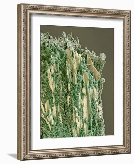 Dental Plaque, SEM-Steve Gschmeissner-Framed Photographic Print