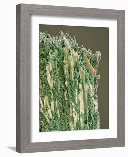 Dental Plaque, SEM-Steve Gschmeissner-Framed Photographic Print