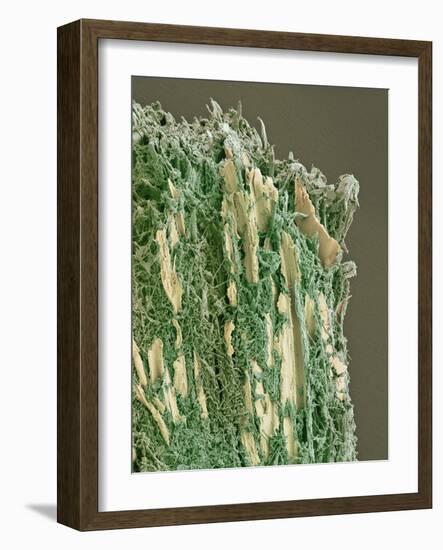 Dental Plaque, SEM-Steve Gschmeissner-Framed Photographic Print