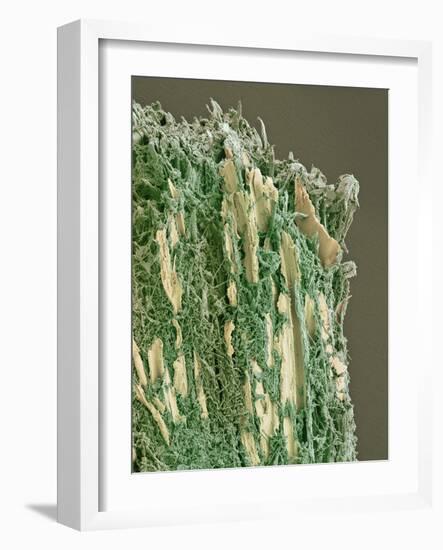 Dental Plaque, SEM-Steve Gschmeissner-Framed Photographic Print