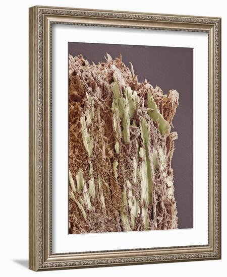 Dental Plaque, SEM-Steve Gschmeissner-Framed Photographic Print