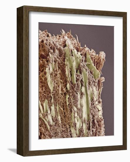 Dental Plaque, SEM-Steve Gschmeissner-Framed Photographic Print