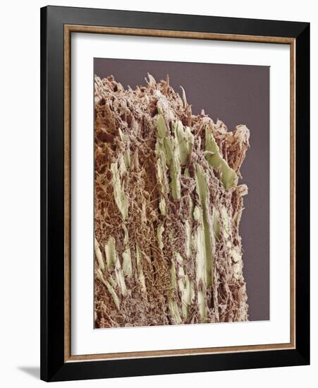 Dental Plaque, SEM-Steve Gschmeissner-Framed Photographic Print