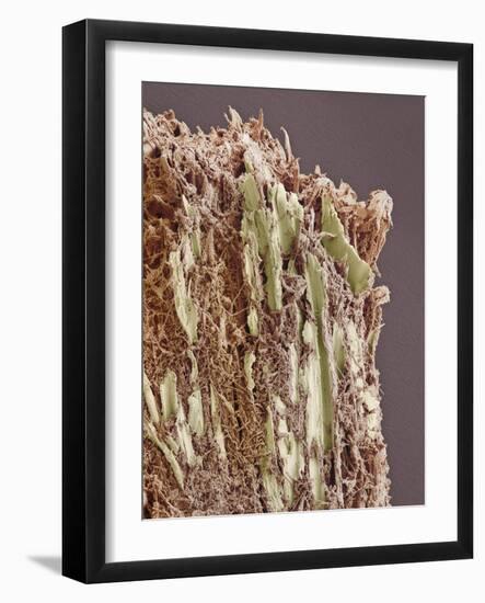 Dental Plaque, SEM-Steve Gschmeissner-Framed Photographic Print