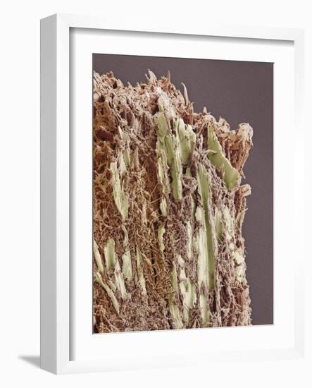 Dental Plaque, SEM-Steve Gschmeissner-Framed Photographic Print