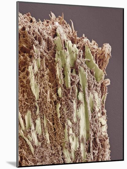 Dental Plaque, SEM-Steve Gschmeissner-Mounted Photographic Print