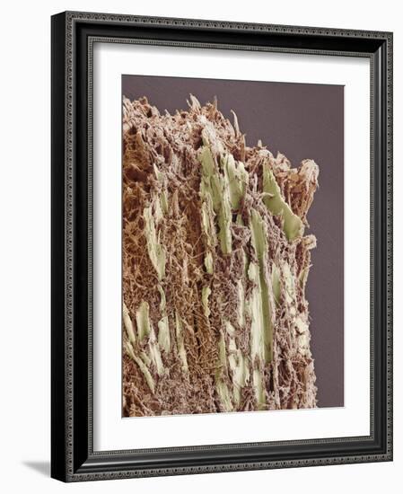 Dental Plaque, SEM-Steve Gschmeissner-Framed Photographic Print