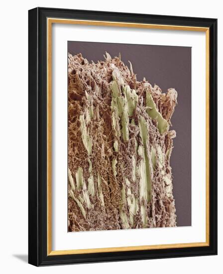 Dental Plaque, SEM-Steve Gschmeissner-Framed Photographic Print