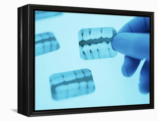 Dental X-rays-Lawrence Lawry-Framed Premier Image Canvas