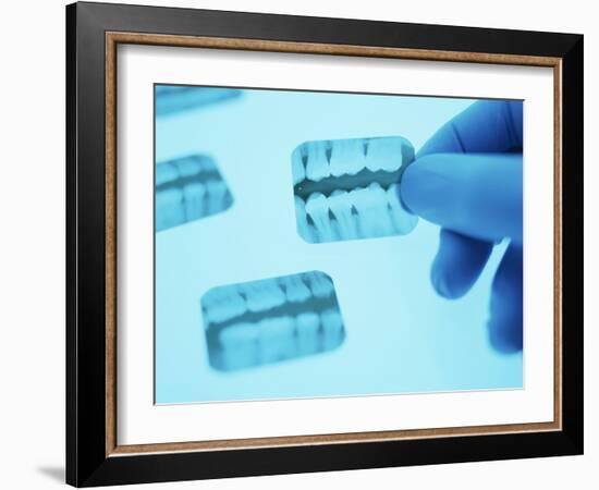 Dental X-rays-Lawrence Lawry-Framed Photographic Print