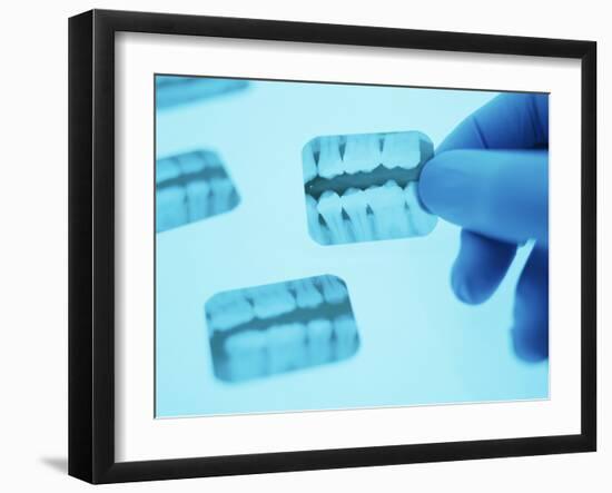 Dental X-rays-Lawrence Lawry-Framed Photographic Print