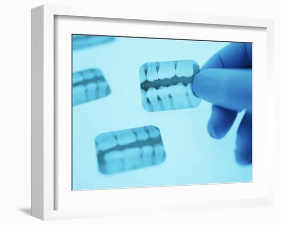 Dental X-rays-Lawrence Lawry-Framed Photographic Print