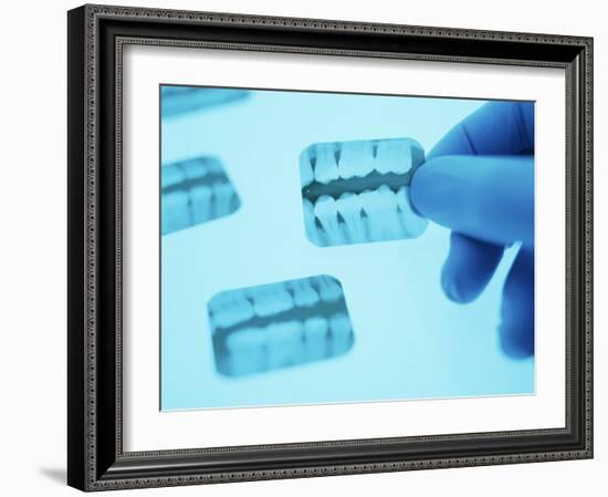 Dental X-rays-Lawrence Lawry-Framed Photographic Print