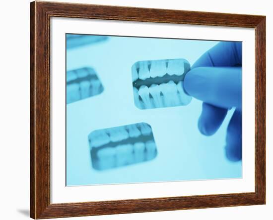 Dental X-rays-Lawrence Lawry-Framed Photographic Print