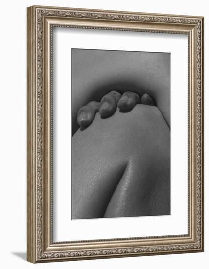 Detailed Texture of Human Female Skin. close up Part of Woman's Body. Skincare, Bodycare, Healthcar-master1305-Framed Photographic Print