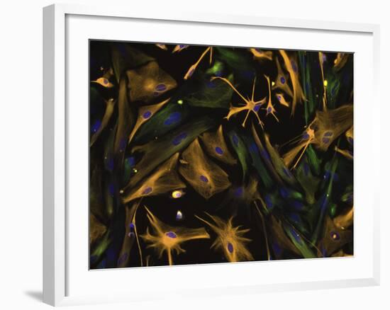 Directed Differentiation of Multipotential Human Neural Progenitor Cells-Stocktrek Images-Framed Photographic Print