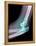 Dislocated Elbow, X-ray-Du Cane Medical-Framed Premier Image Canvas