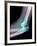 Dislocated Elbow, X-ray-Du Cane Medical-Framed Photographic Print