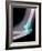 Dislocated Elbow, X-ray-Du Cane Medical-Framed Photographic Print