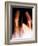 Dislocated Finger Joint, X-ray-ZEPHYR-Framed Photographic Print