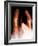 Dislocated Finger Joint, X-ray-ZEPHYR-Framed Photographic Print