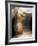 Dislocated Neck Bones, X-ray-ZEPHYR-Framed Photographic Print