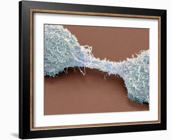 Dividing Brain Cancer Cells, SEM-Steve Gschmeissner-Framed Photographic Print