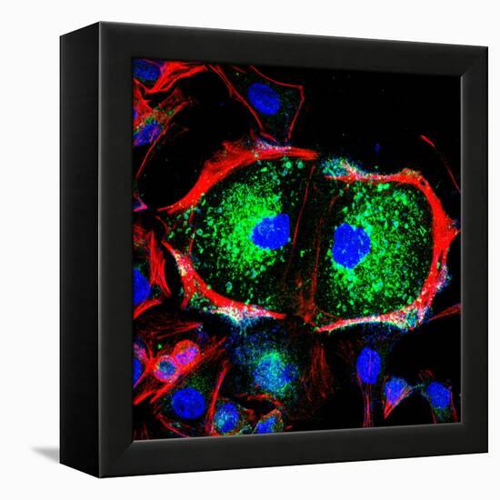 Dividing Cell, Light Micrograph-Science Photo Library-Framed Premier Image Canvas