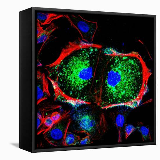 Dividing Cell, Light Micrograph-Science Photo Library-Framed Premier Image Canvas